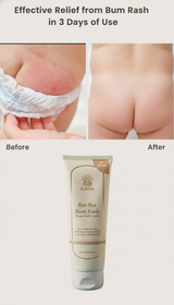Bye-Bye Bum Rash Cream
