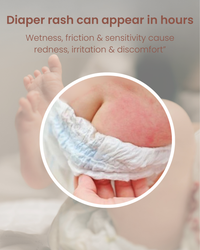 Bye-Bye Bum Rash Cream