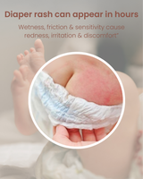 Bye-Bye Bum Rash Cream